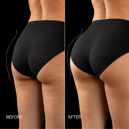 EMS Toning Shorts